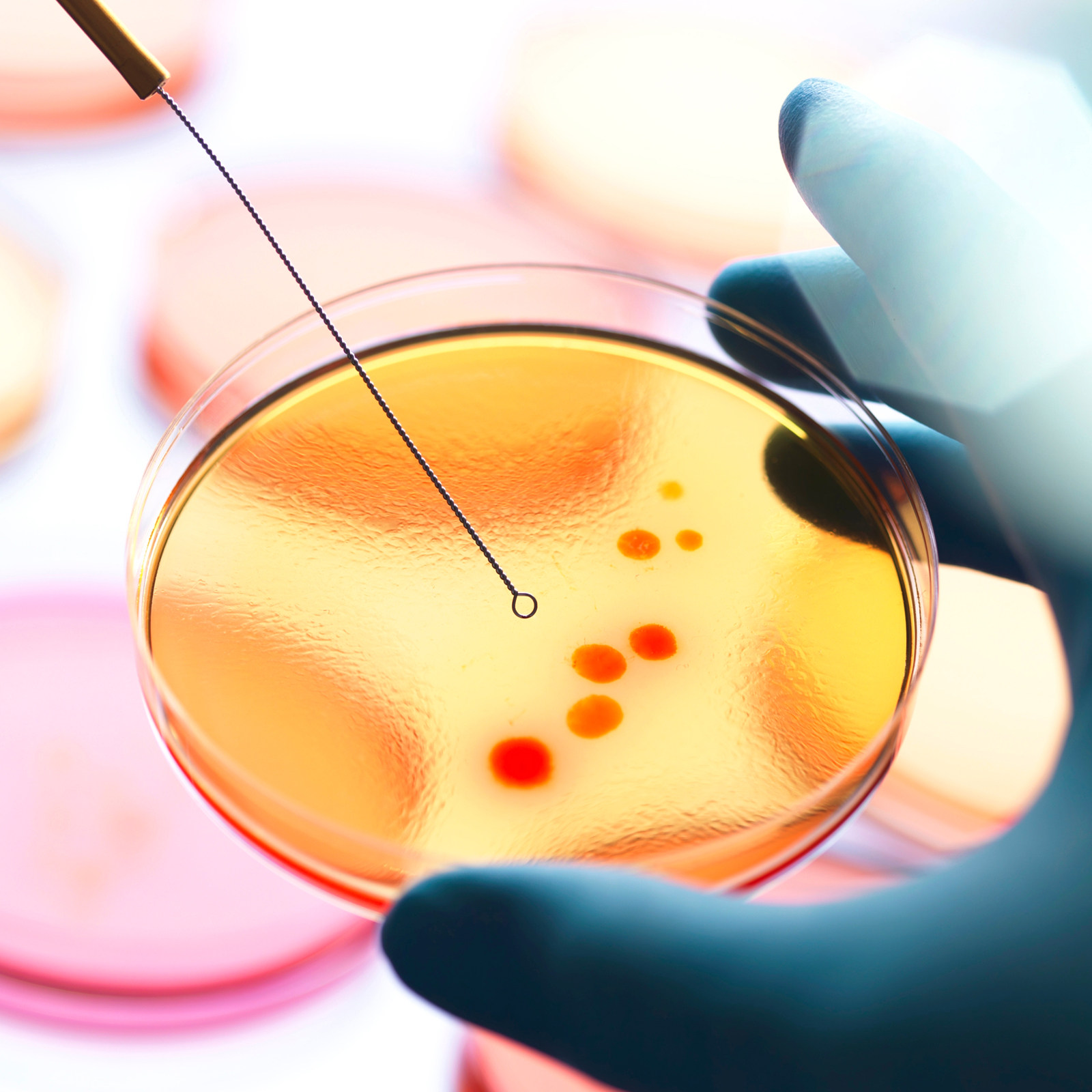 จานเพาะเชื้อวุ้นพร้อมสารอาหาร  - Agar Tissue Culture บทวิจารณ์และราคา